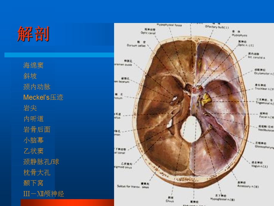 《侧颅底入路武文明》PPT课件.ppt_第2页