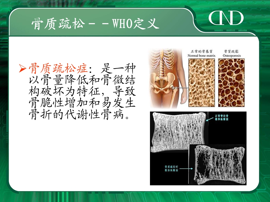 《骨科常见病》PPT课件.ppt_第3页