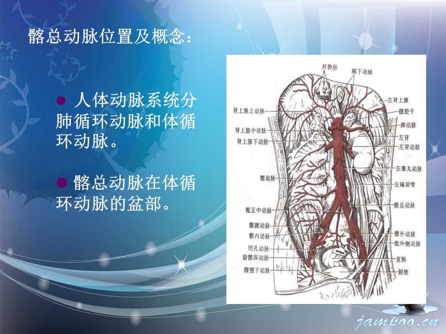 《髂总动脉闭塞》PPT课件.ppt_第2页