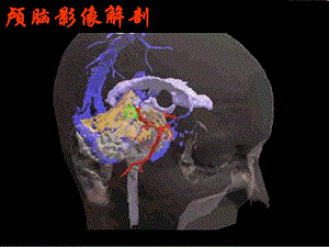 《颅脑影像解剖》PPT课件.ppt