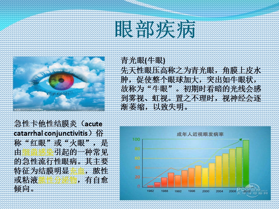 《用眼卫生知识宣传》PPT课件.ppt_第2页