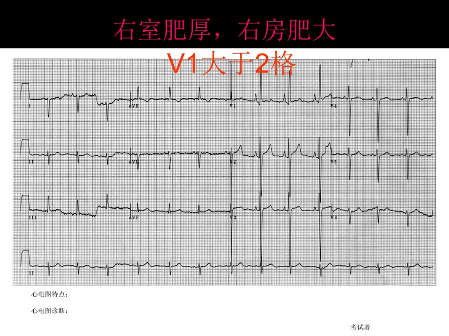 《规培常见心电图》PPT课件.ppt_第2页