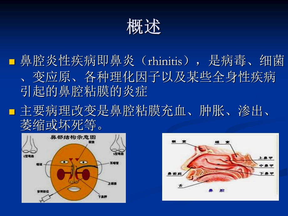 《鼻腔炎性疾病》PPT课件.ppt_第2页