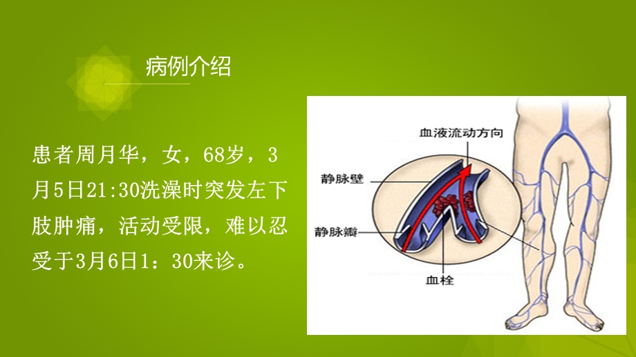 《静脉血栓夏历》PPT课件.ppt_第3页