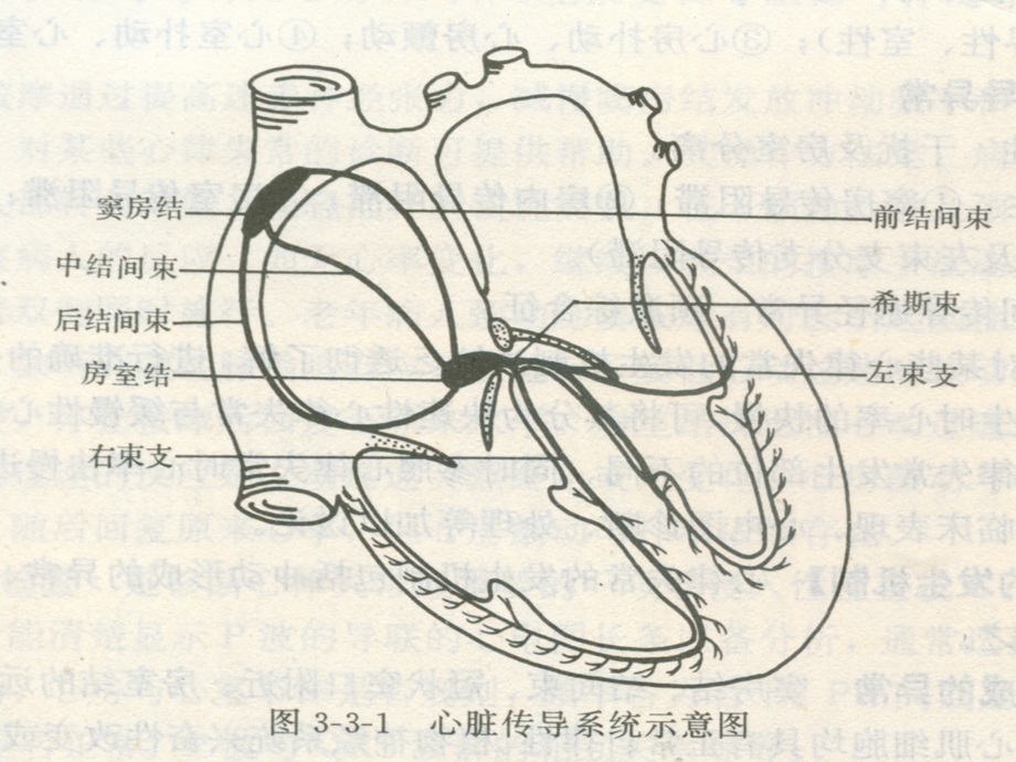 《心电图判读》PPT课件.ppt_第3页