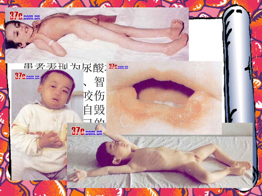 自毁容貌综合症.ppt_第3页