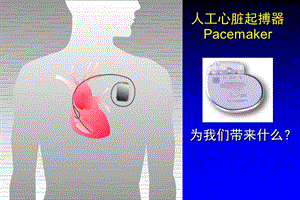 《起搏器及相关》PPT课件.ppt