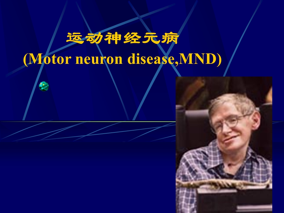 运动神经元病MotorneurondiseaseMND.ppt_第1页