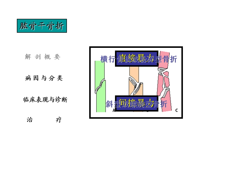 《肱骨干骨折》PPT课件.ppt_第3页