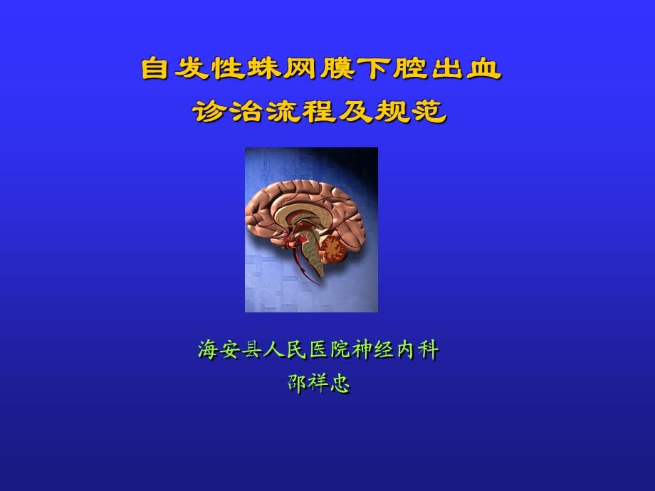 自发性蛛网膜下腔出血诊治流程及规范().ppt_第1页