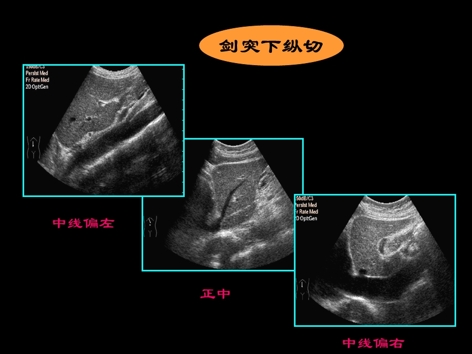 《超声肝胆胰脾》PPT课件.ppt_第3页