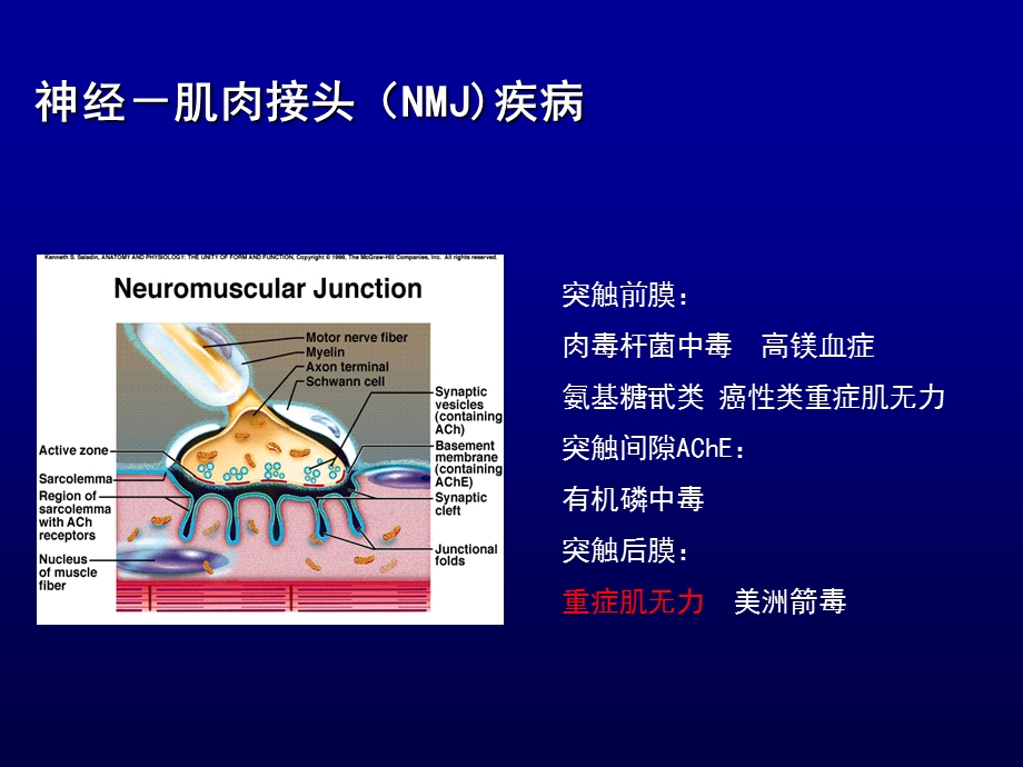 重症肌无力及周期性麻痹.ppt_第3页