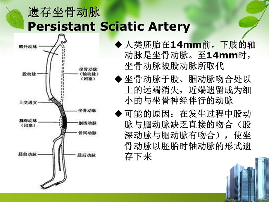 遗存坐骨动脉一例课件.ppt_第2页