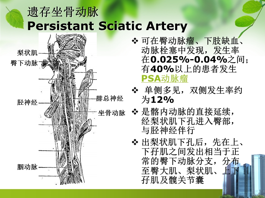 遗存坐骨动脉一例课件.ppt_第3页