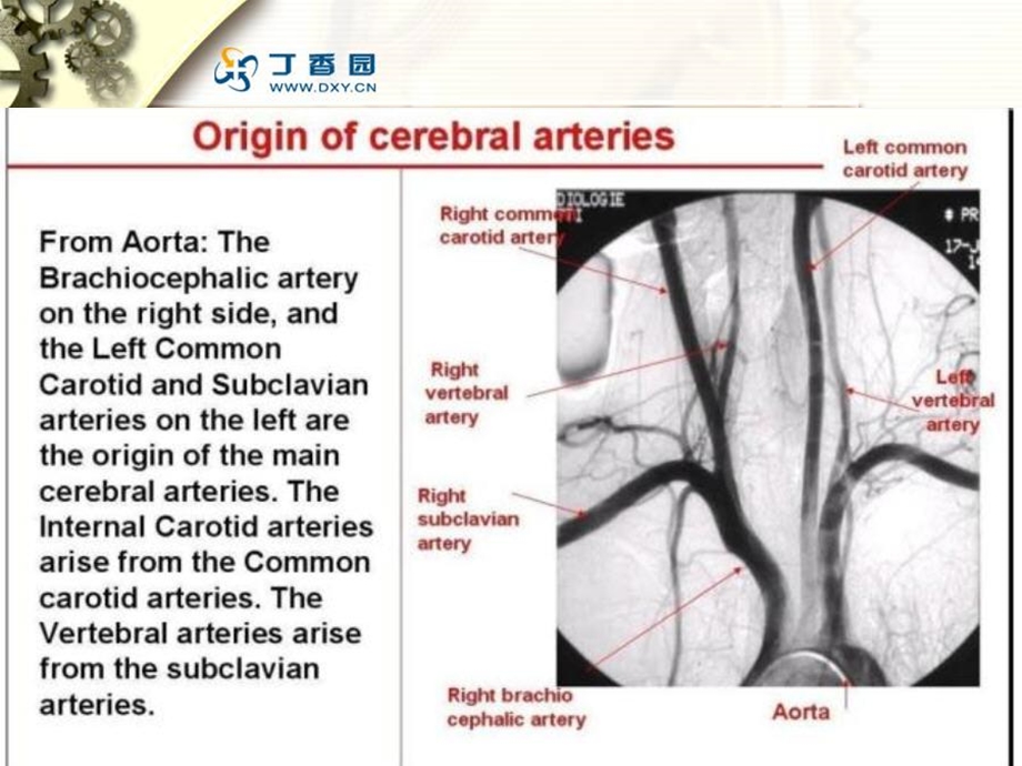 《脑血管解剖与造影》PPT课件.ppt_第3页