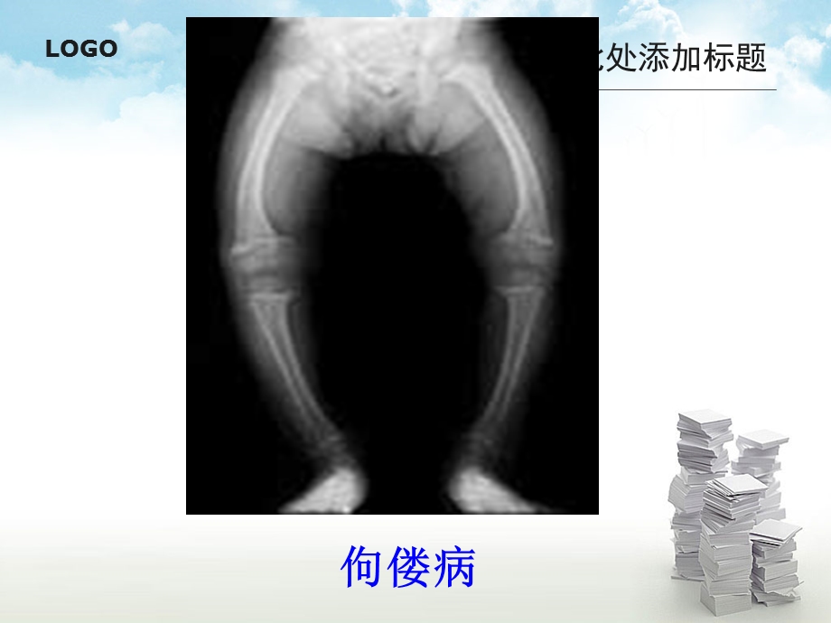 《食物中的营养物质》PPT课件.ppt_第3页