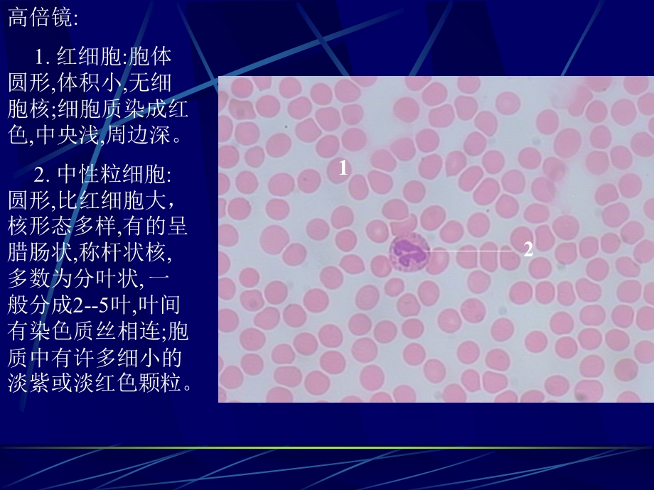 《血液和骨髓涂》PPT课件.ppt_第3页