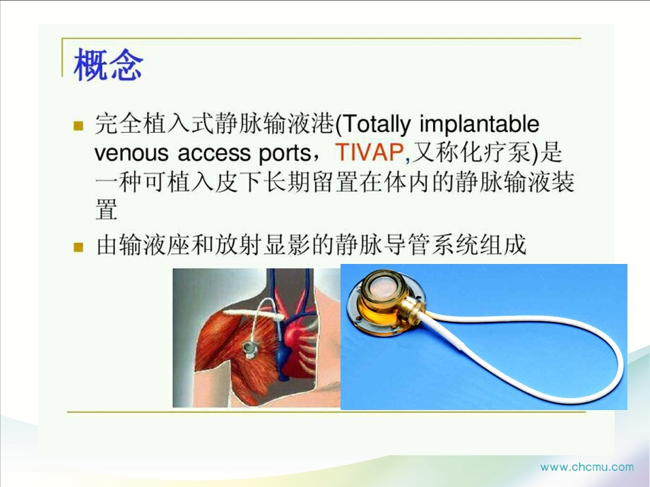 《输液港及护理》PPT课件.ppt_第3页