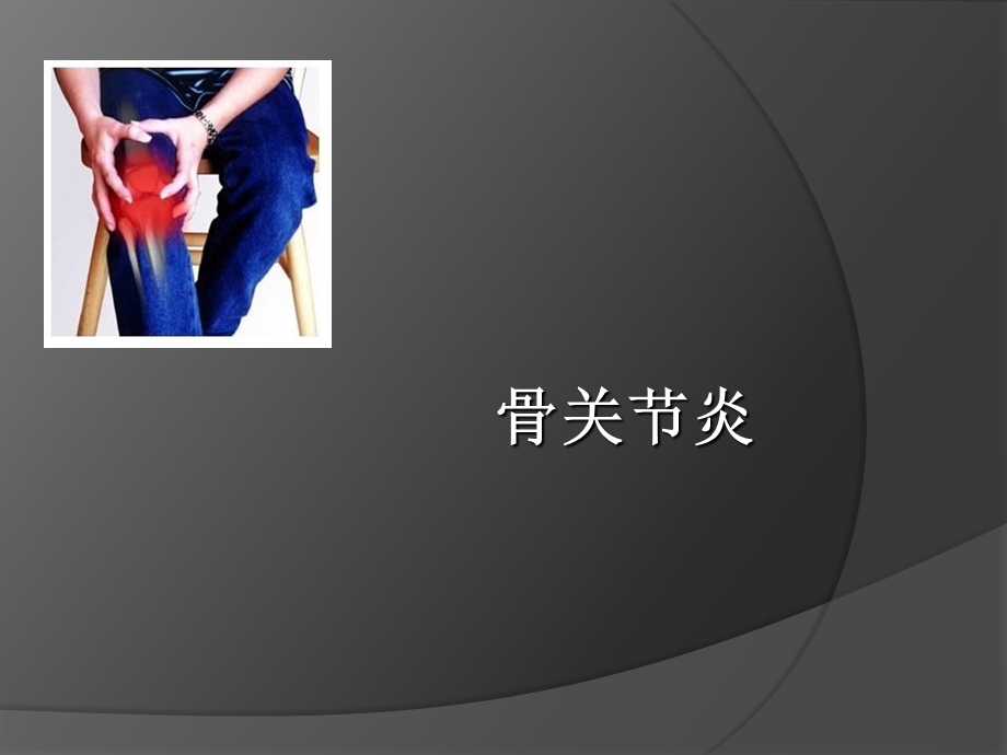 《骨关节炎》PPT课件.ppt_第1页