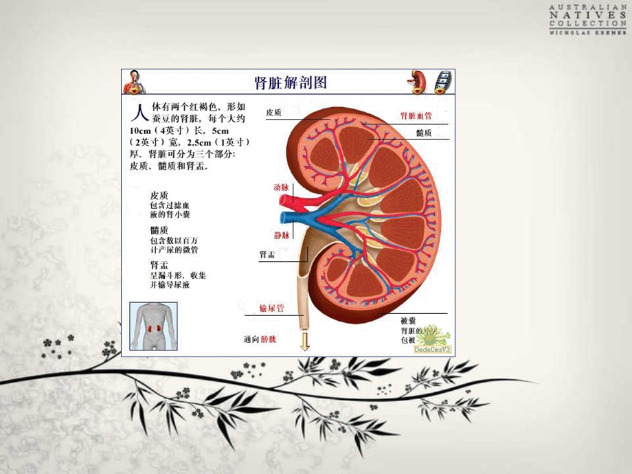 《结石围手术期护理》PPT课件.ppt_第2页