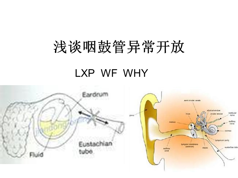 《咽鼓管异常开放》PPT课件.ppt_第1页