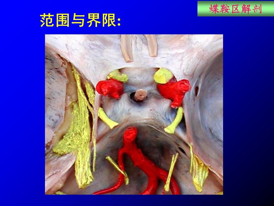 《蝶鞍区应用解剖》PPT课件.ppt_第2页