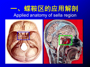 《蝶鞍区应用解剖》PPT课件.ppt