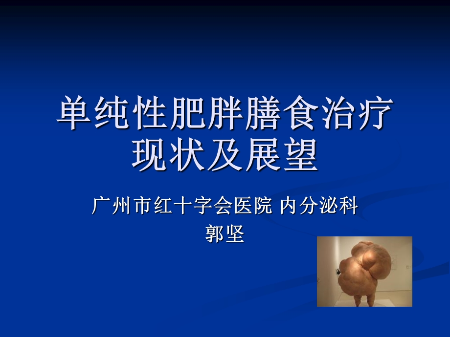 《纯性肥胖膳食治疗》PPT课件.ppt_第1页