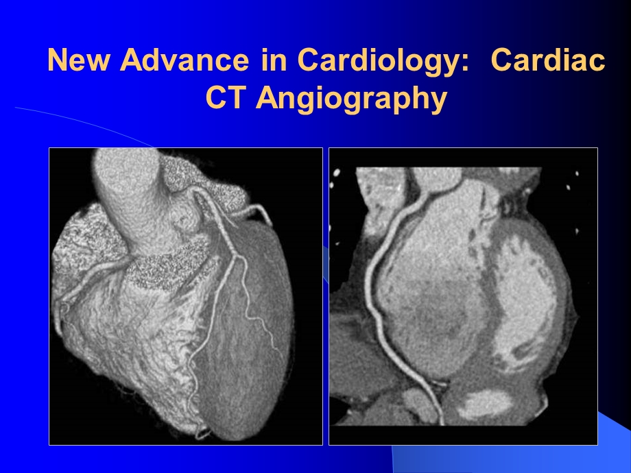 造影剂肾病CIN的防治contrastinducednephropathy.ppt_第3页