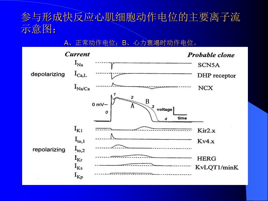 《长QT综合征》PPT课件.ppt_第3页