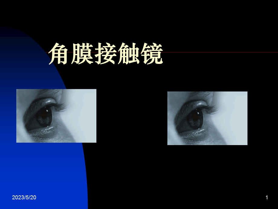 《隐形眼镜基础》PPT课件.ppt_第1页