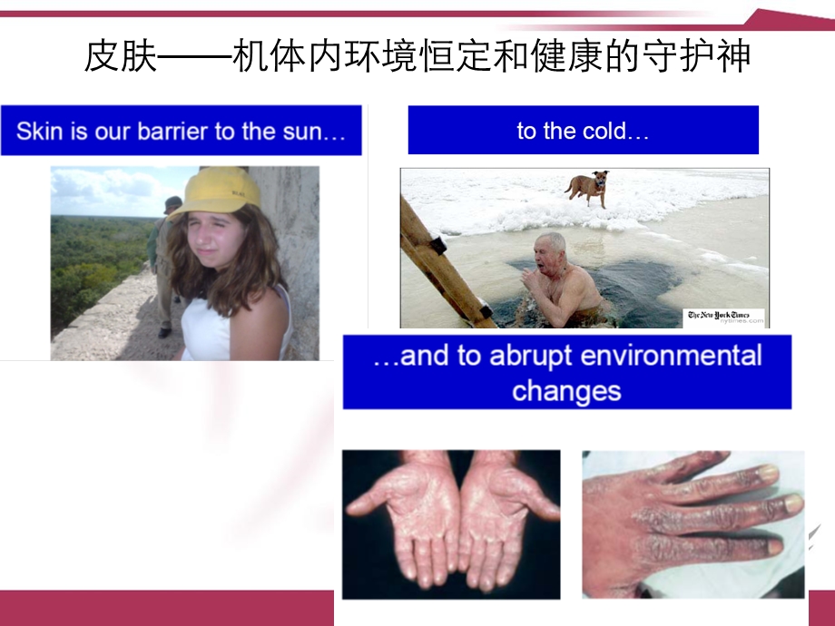 《皮肤屏障功能》PPT课件.ppt_第3页