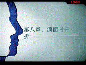 《颌面骨折》PPT课件.ppt