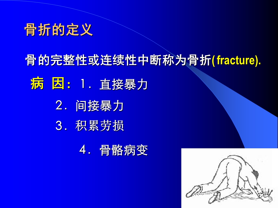 《骨折病人的护理》PPT课件.ppt_第3页