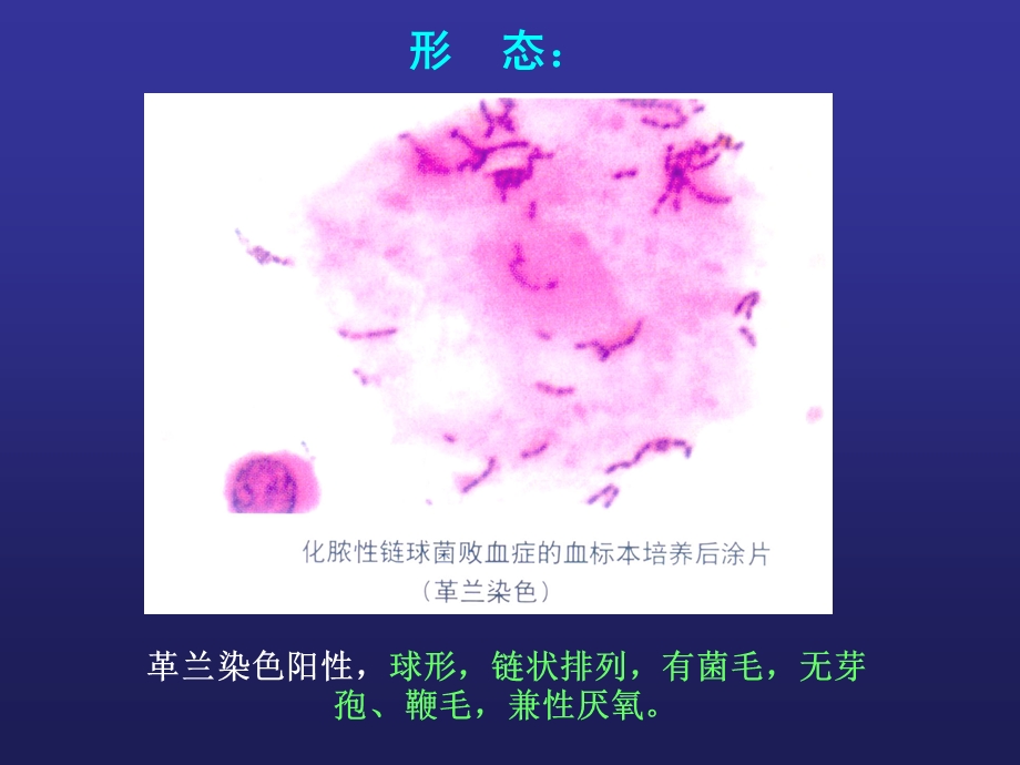 《链球菌感染》PPT课件.ppt_第2页