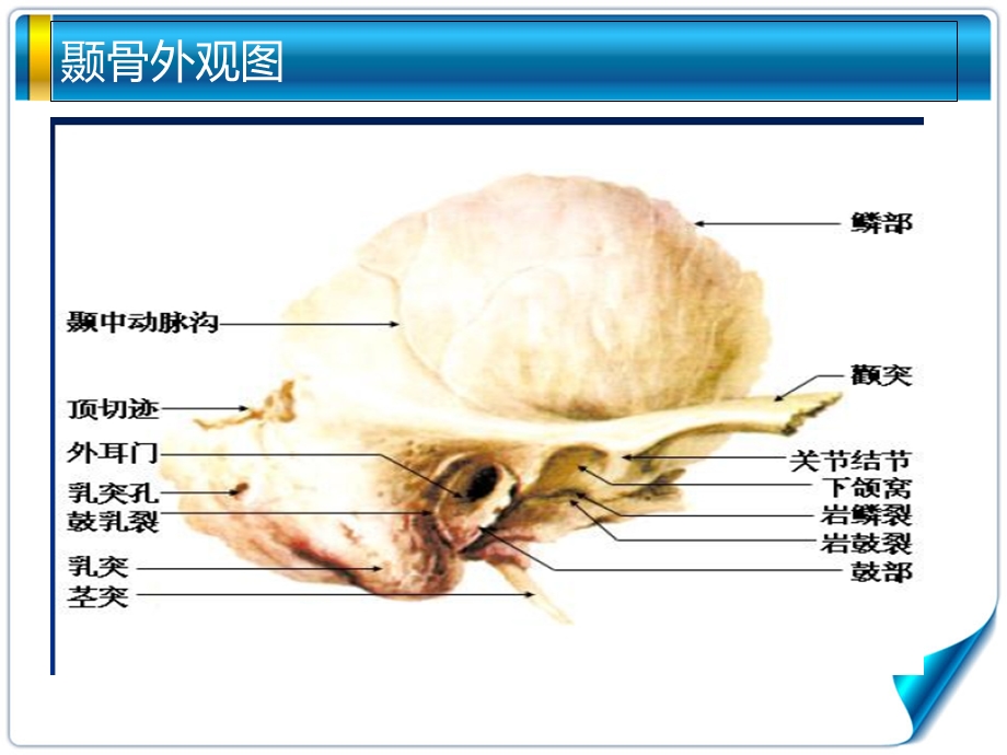 《听觉系统解剖》PPT课件.ppt_第3页