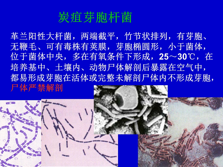 《需氧革兰阳性杆菌》PPT课件.ppt_第3页