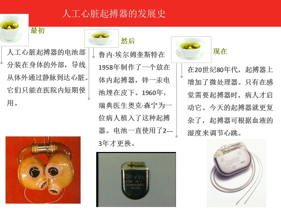 心脏起搏器术前术后护理要点.ppt_第3页