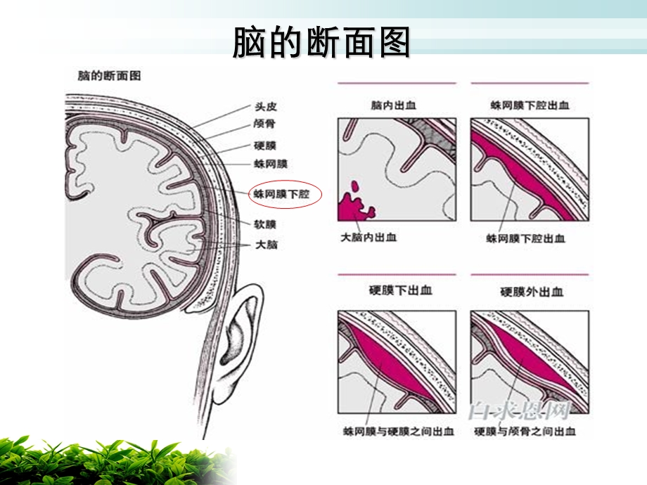 《脑脊液耳漏》PPT课件.ppt_第3页