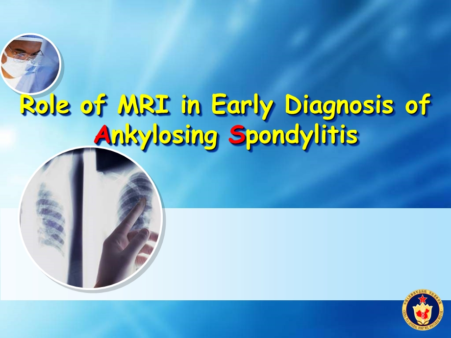 Role of MRI in Early Diagnosis of Ankylosing SpondylitisSIJ.ppt_第1页