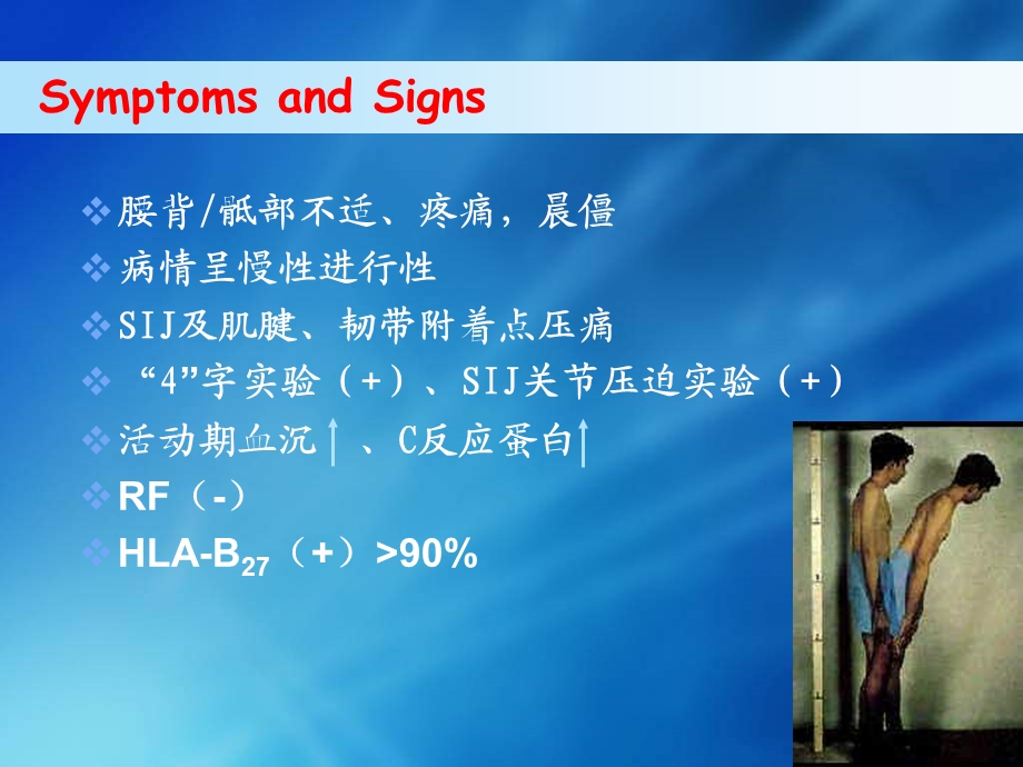 Role of MRI in Early Diagnosis of Ankylosing SpondylitisSIJ.ppt_第3页