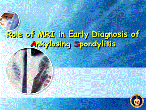 Role of MRI in Early Diagnosis of Ankylosing SpondylitisSIJ.ppt