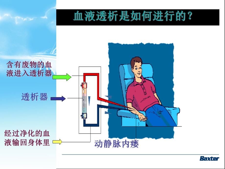 《血液透析原理》PPT课件.ppt_第2页