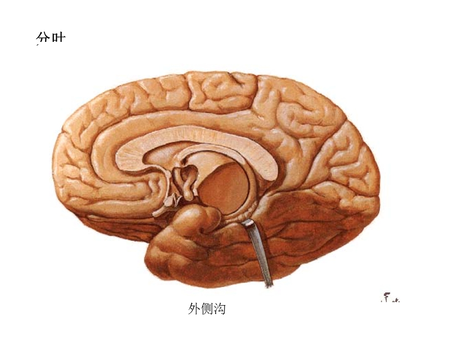 端脑ppt课件.ppt_第2页