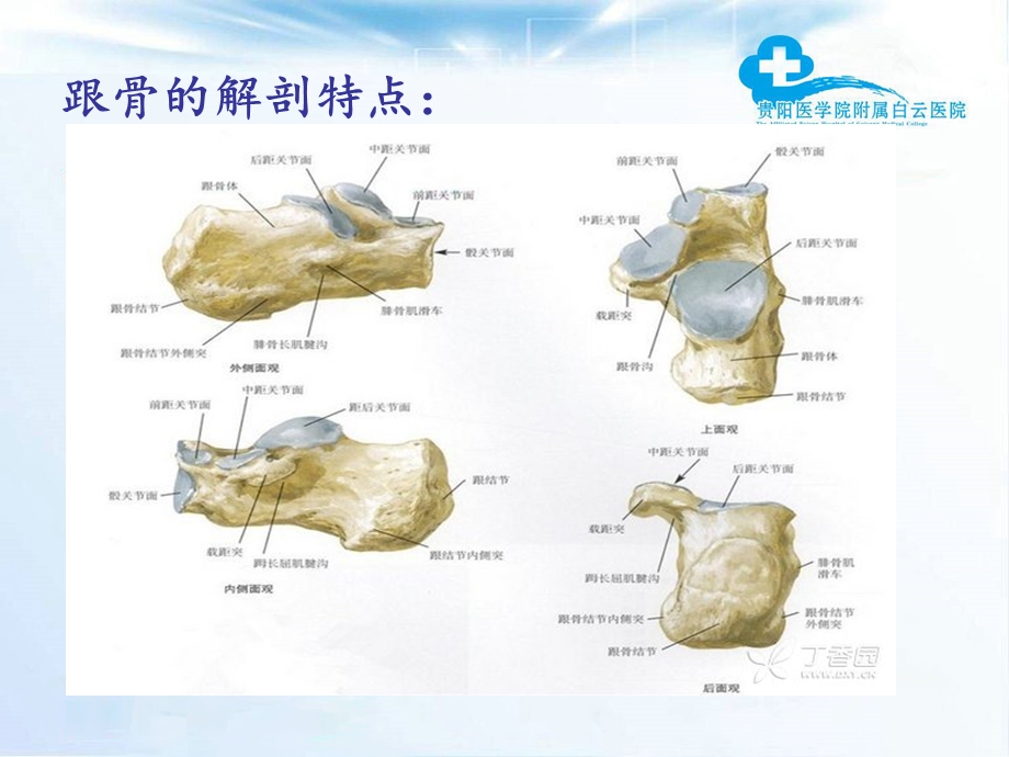 《跟骨骨折》PPT课件.ppt_第3页