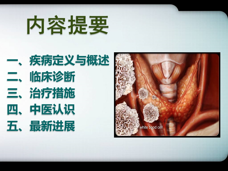 《桥本 甲状腺炎》PPT课件.ppt_第2页