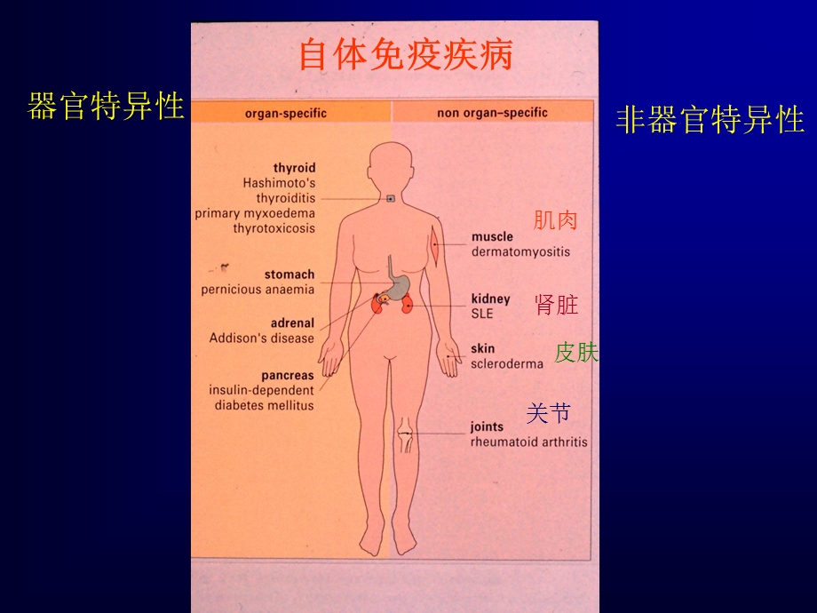 自体免疫疾病.ppt_第2页