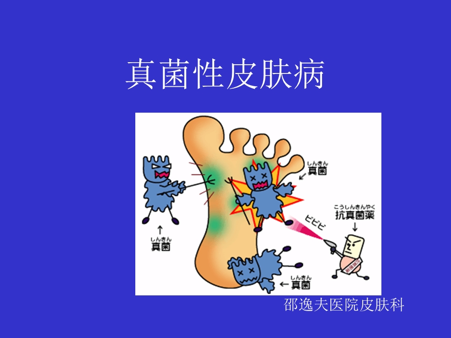 真菌性感染.ppt_第1页