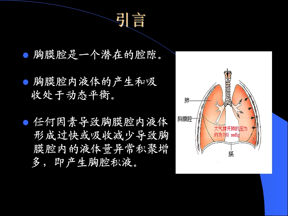 《结核性胸膜炎》PPT课件.ppt_第2页