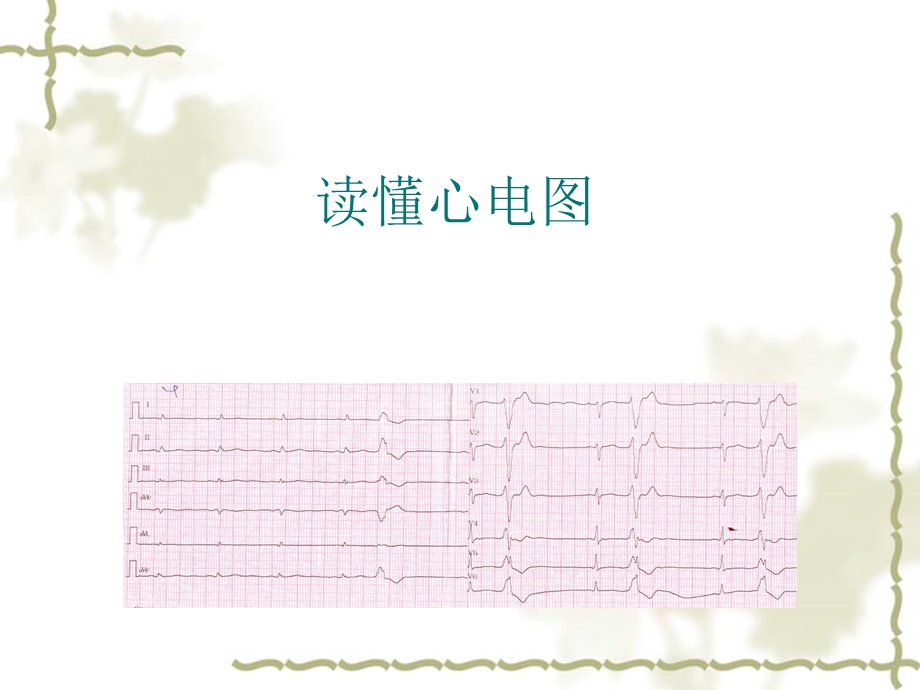 《读懂心电》PPT课件.ppt_第1页